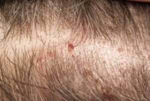 AF26C6E1-53F1-476A-BFC7-9EB552F1691B